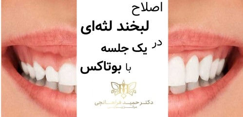 بدون نیاز به جراحی صاحب چهره و لبخندي دلنشين مي شويد.