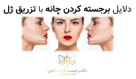 تزریق ژل باعث تناسب و تعادل در چهره است.