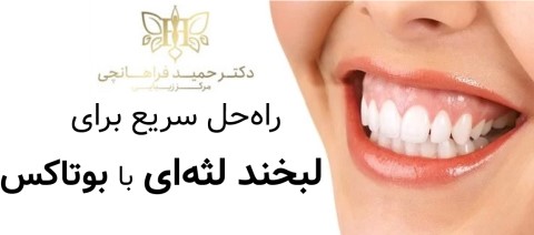 با بوتاکس لبخندي زيبا و طبيعي خواهيد داشت.
