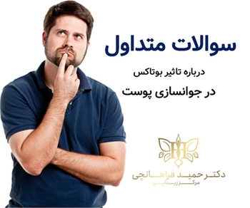 سوالات متداول درباره تاثیر بوتاکس در جوانسازی پوست