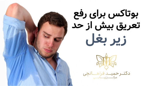 بوتاکس برای رفع تعریق بیش از حد زیر بغل