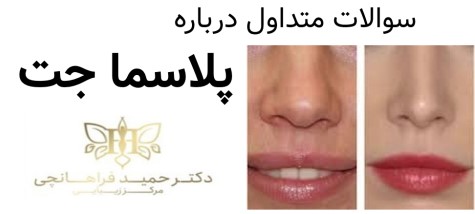 با خواندن سوالات بیشتر می توانید اطلاعات خود را در این زمینه افزایش دهید.