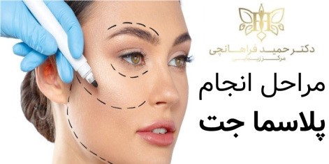 ابتدا پوست شما توسط پزشک بررسی می شود.
