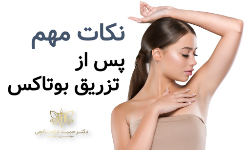 نکات مهم پس از تزریق بوتاکس