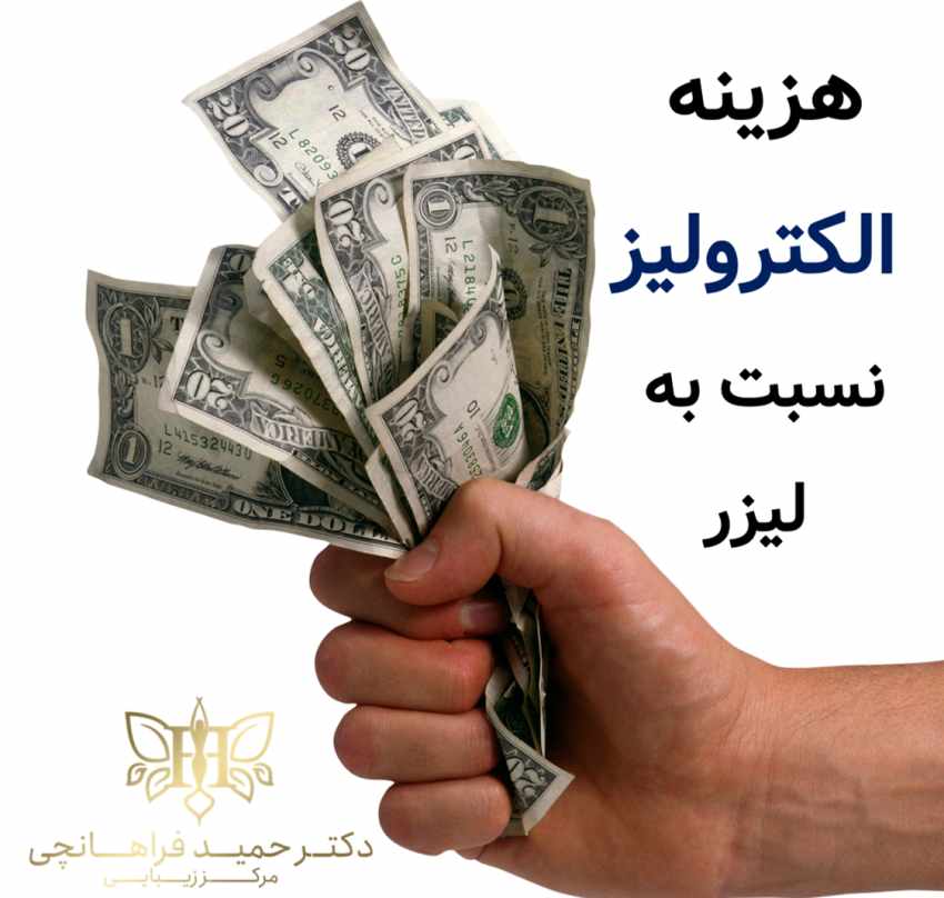 قیمت الکترولیز نسبت به لیزر