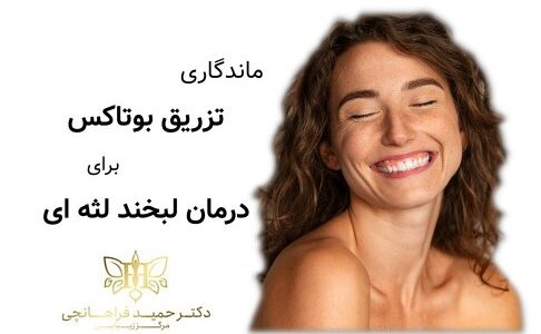 ماندگاری تزریق بوتاکس برای درمان لبخند لثه ای