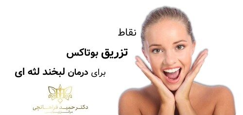 نقاط تزریق بوتاکس برای درمان لبخند لثه ای