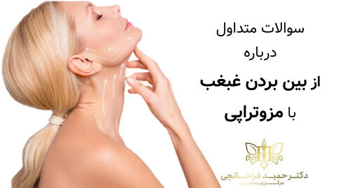 سوالات متداول درباره <yoastmark class=