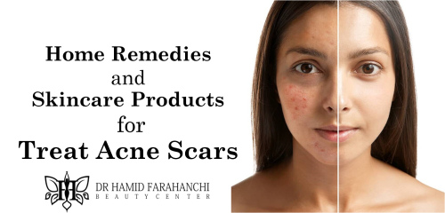 Can Home Remedies and Skincare Products Effectively Treat Acne Scars