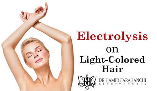 Does Electrolysis Work on Fine or Light-Colored Hair