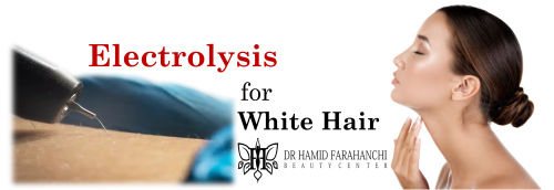 Electrolysis for White Hair The Permanent Solution to Stubborn, Unwanted Hairs
