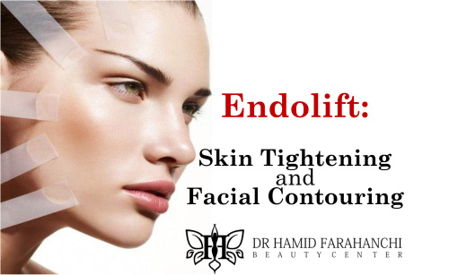 Endolift The Revolutionary Laser Treatment for Skin Tightening and Facial Contouring