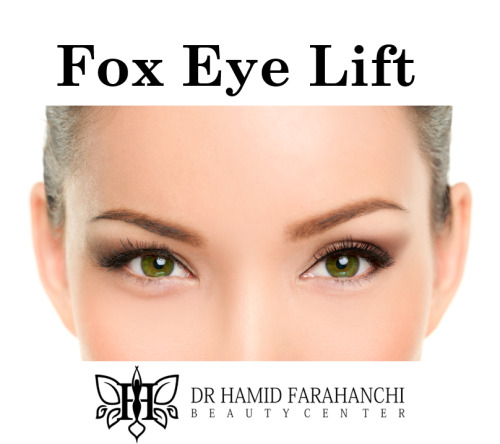 Fox Eye Lift The Trendy Procedure for a Snatched Look
