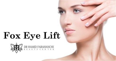 Fox Eye Lift a Snatched Look