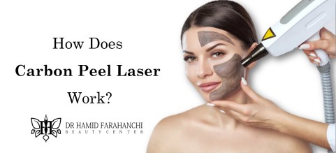 How Does Carbon Peel Laser Work The Science Behind This Revolutionary Treatment