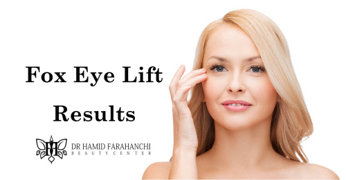 How Long Do Fox Eye Lift Results Last
