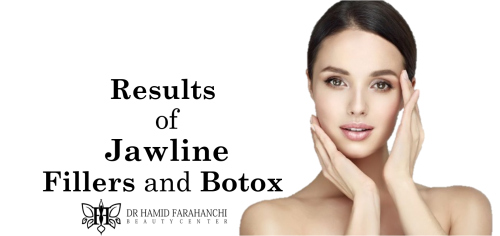 How Long Do the Results of Jawline Fillers and Botox Last
