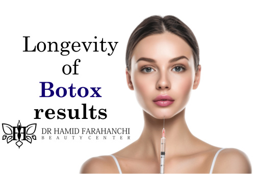 How long do Botox results last