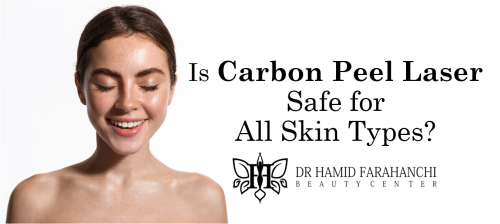 Is Carbon Peel Laser Safe for All Skin Types What You Need to Know