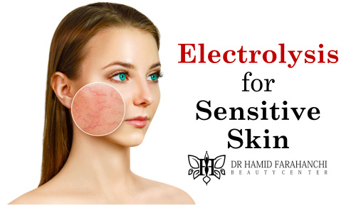 Is Electrolysis Safe for Sensitive Skin and White Hair