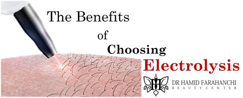 The Benefits of Choosing Electrolysis Over Other Hair Removal Methods