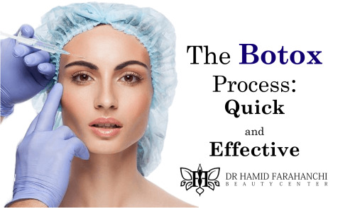 The Botox Process Quick, Effective, and No Downtime