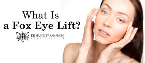 What Is a Fox Eye Lift and How Does It Work