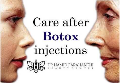 What should I avoid after getting Botox