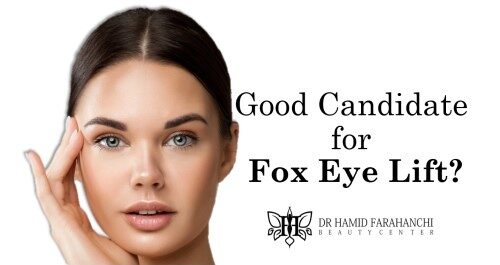 Who Is a Good Candidate for a Fox Eye Lift