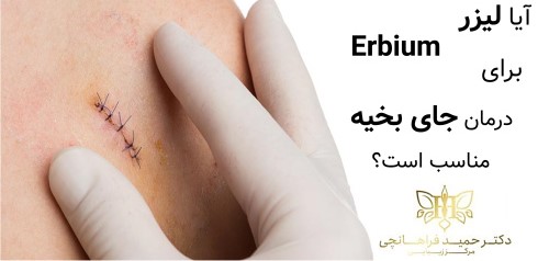 آیا لیزر Erbium برای درمان جای بخیه مناسب است؟