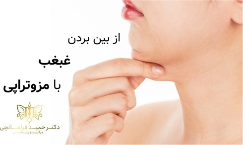 از بین بردن غبغب با مزوتراپی