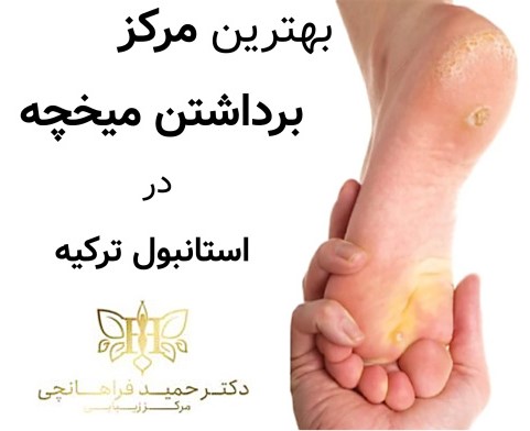 بهترین مرکز برداشتن میخچه در استانبول