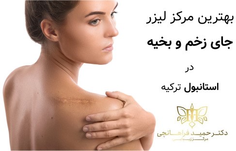 بهترین مرکز لیزر جای زخم و بخیه در استانبول ترکیه