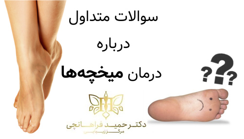 سوالات متداول درباره درمان میخچه ها