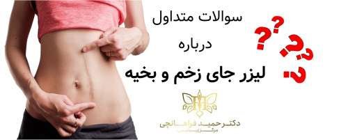 سوالات متداول درباره لیزر جای زخم و بخیه