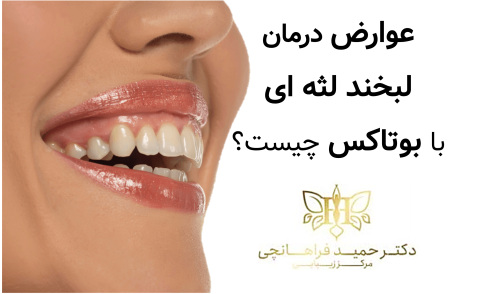 عوارض درمان لبخند لثه ای با بوتاکس چیست