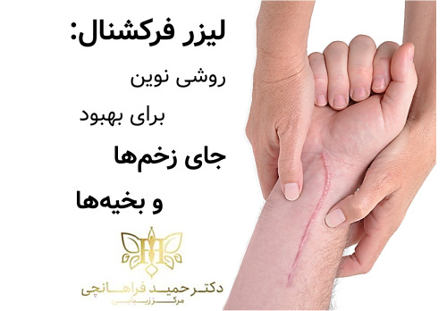 لیزر فرکشنال روشی نوین برای بهبود جای زخم‌ها بخیه‌ها