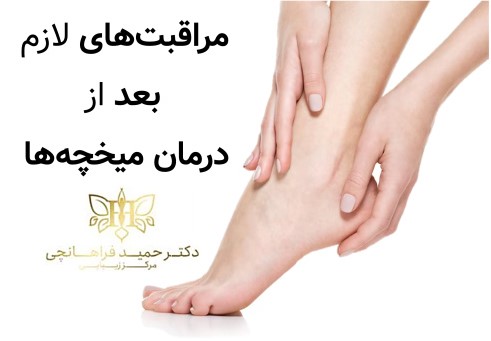 مراقبت‌های لازم بعد از درمان میخچه‌ها