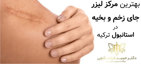 مرکز لیزر جای زخم و بخیه در استانبول ترکیه