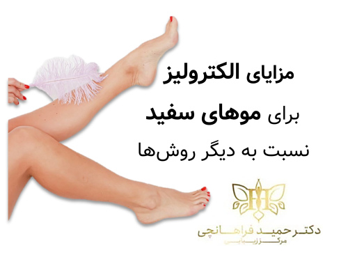 مزایای الکترولیز برای موهای سفید نسبت به سایر روش ها