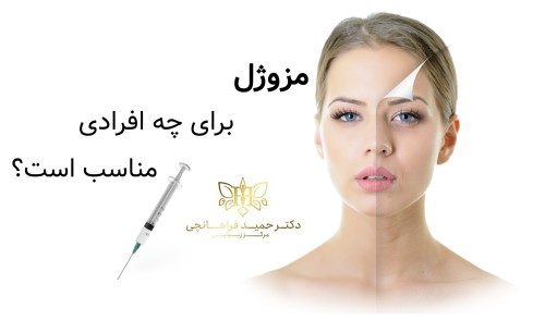 مزوژل برای چه افرادی مناسب است؟