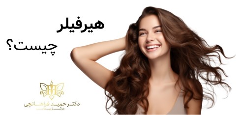 هیرفیلر چیست؟