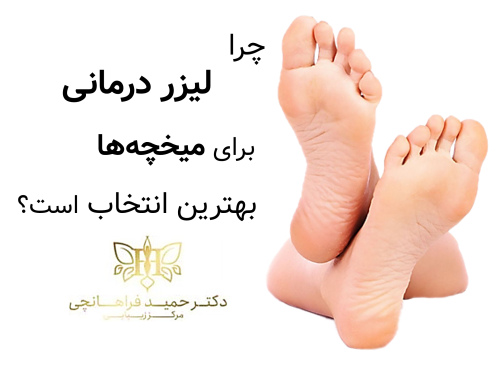 چرا لیزر درمانی برای میخچه‌ها بهترین انتخاب است؟