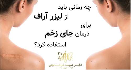 چه زمانی باید از لیزر آراف برای درمان جای زخم استفاده کرد؟